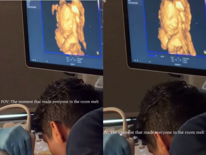 Bebê sorri ao ouvir a voz do pai durante ultrassom 3D e vídeo emociona milhões